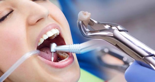 Rüyada Diş Çektirmek