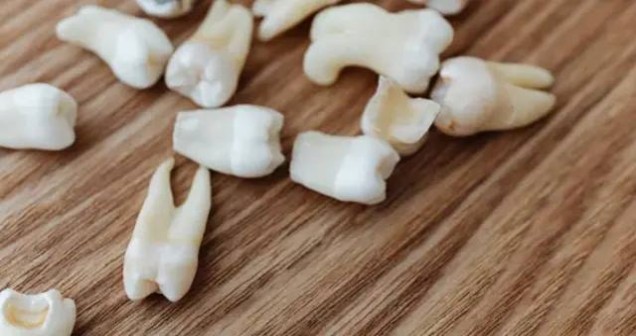 Rüyada Diş Kırılması Ne Anlama Gelir?